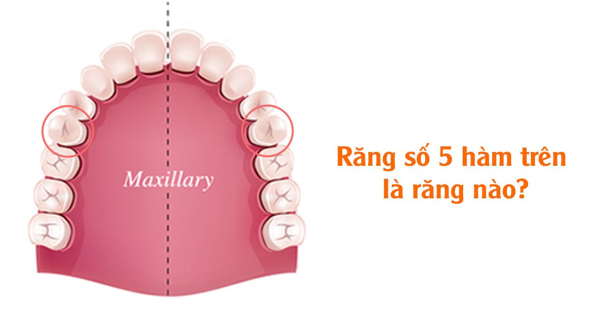 Răng số 5 hàm trên là răng nào?