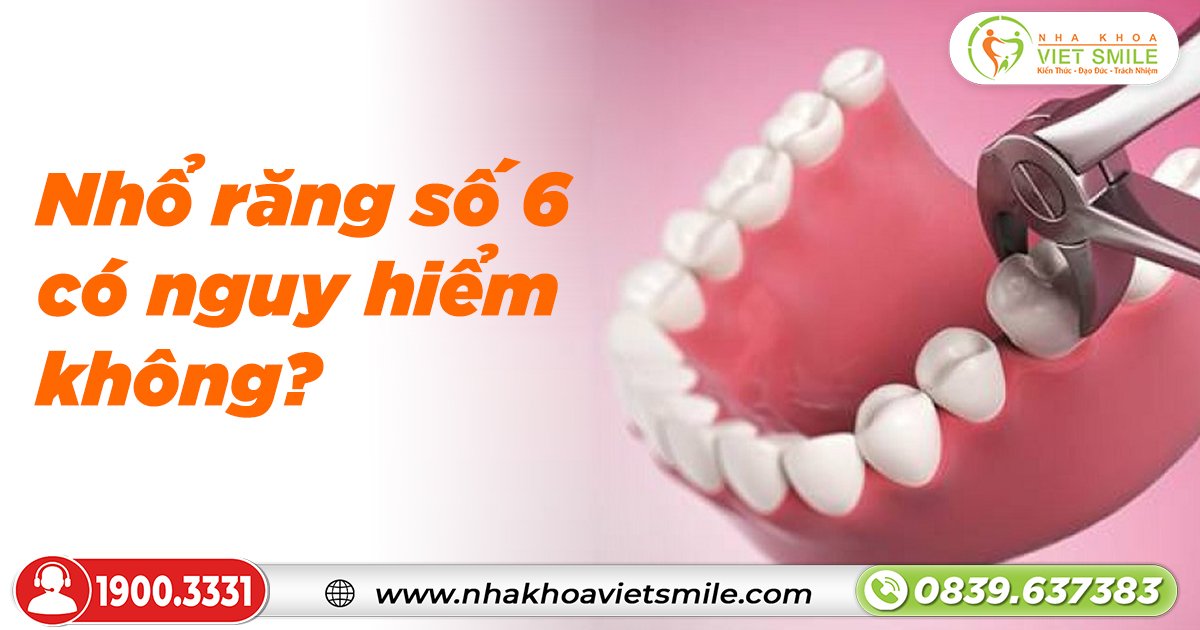 Nhổ răng số 6 có nguy hiểm không?