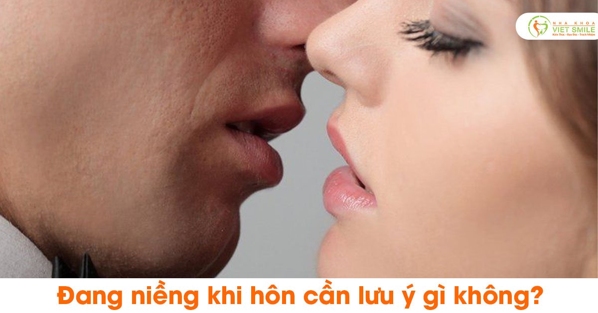 Đang niềng khi hôn cần lưu ý gì không?