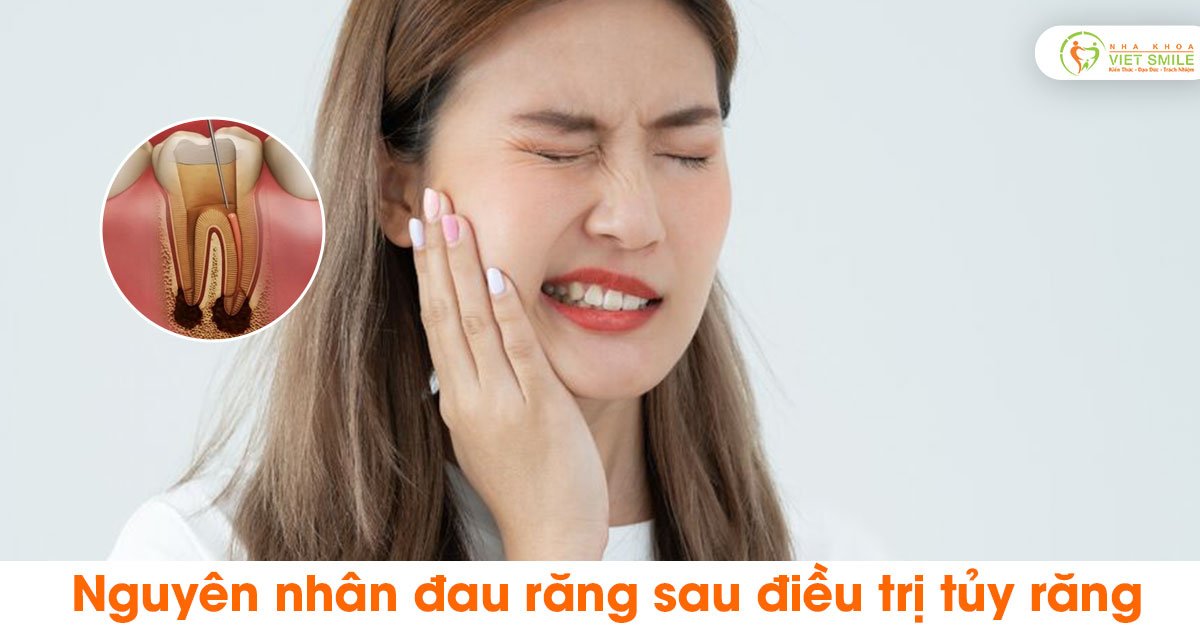 Nguyên nhân đau răng sau điều trị tủy răng