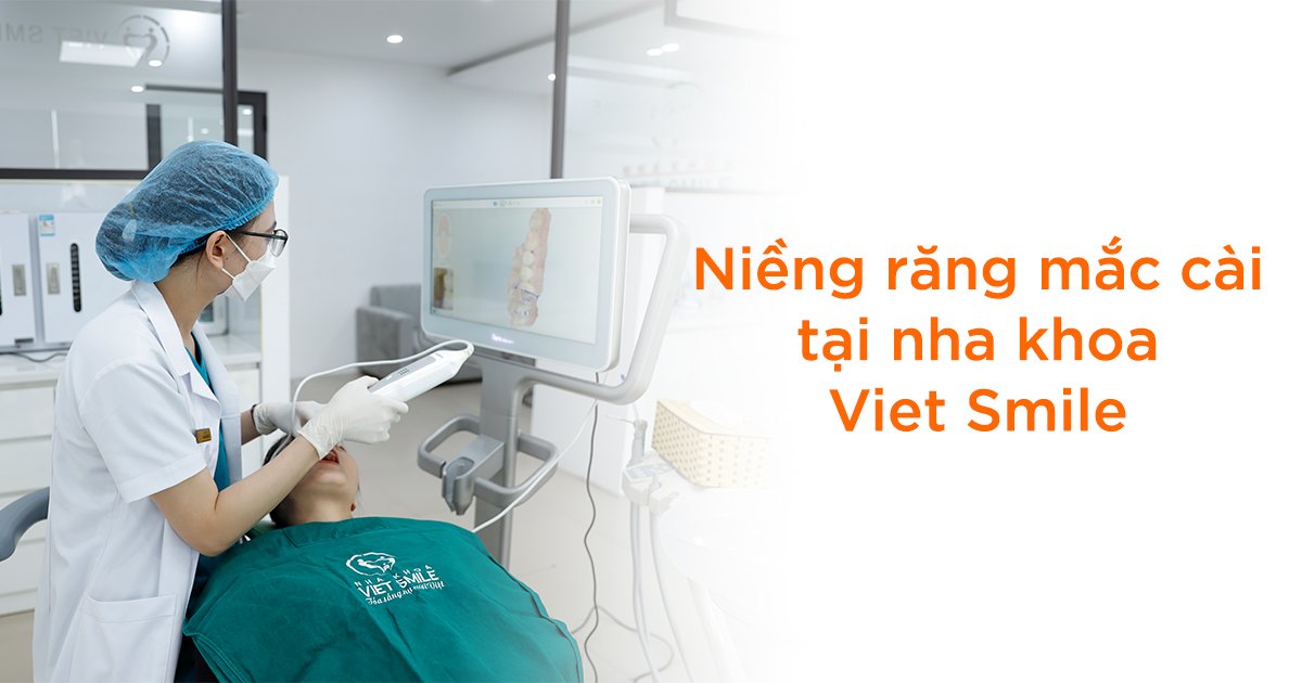 Niềng răng mắc cài tại nha khoa Viet Smile