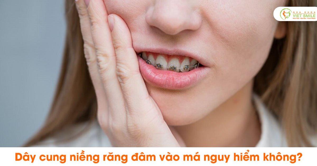 Dây cung niềng răng đâm vào má nguy hiểm không?