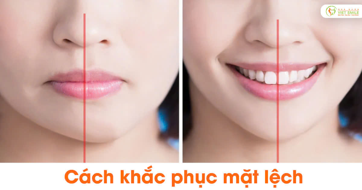 Cách khắc phục mặt lệch