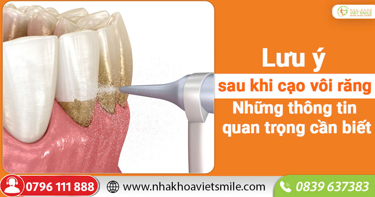 Lưu ý sau khi cạo vôi răng? Những thông tin quan trọng cần biết