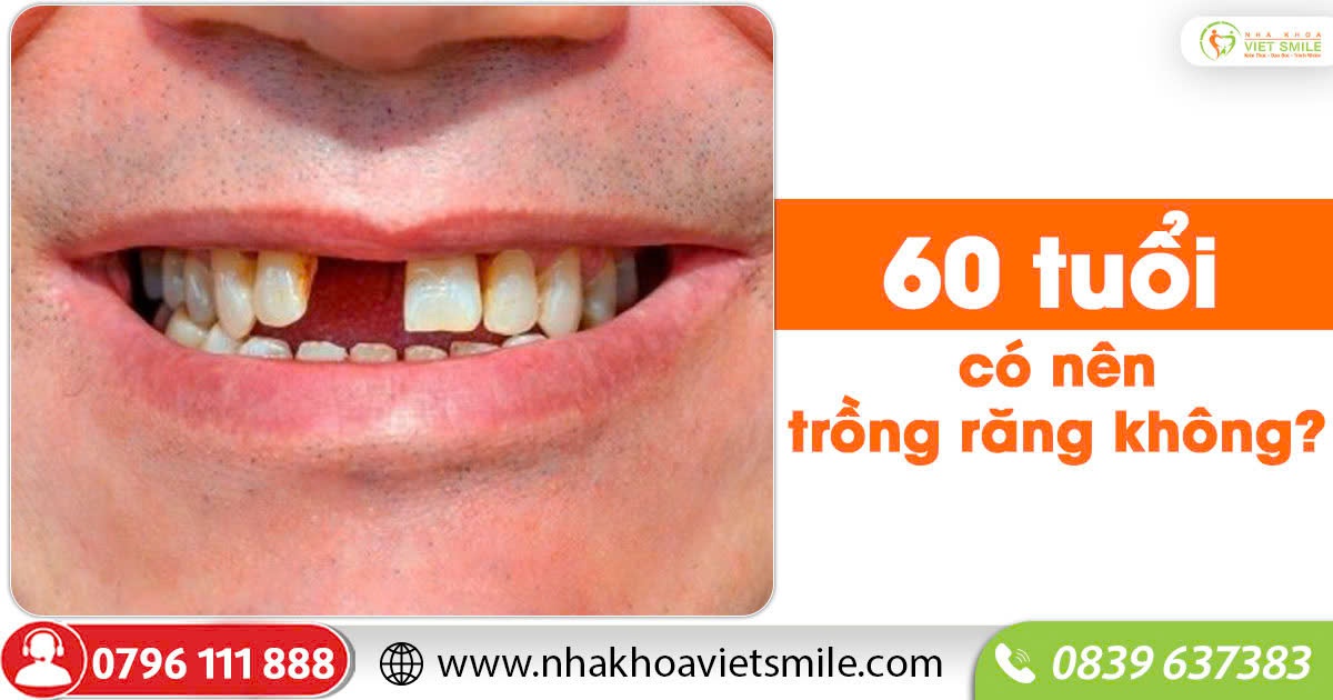 60 tuổi có nên trồng răng không?