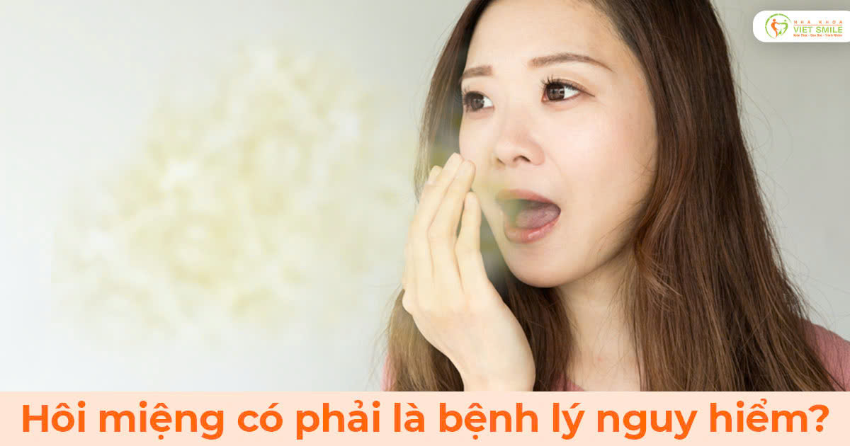 Hôi miệng có phải là bệnh lý nguy hiểm?