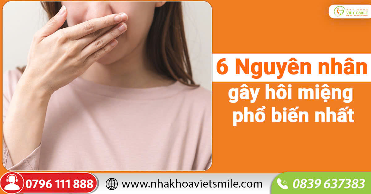 6 Nguyên nhân gây hôi miệng phổ biến nhất