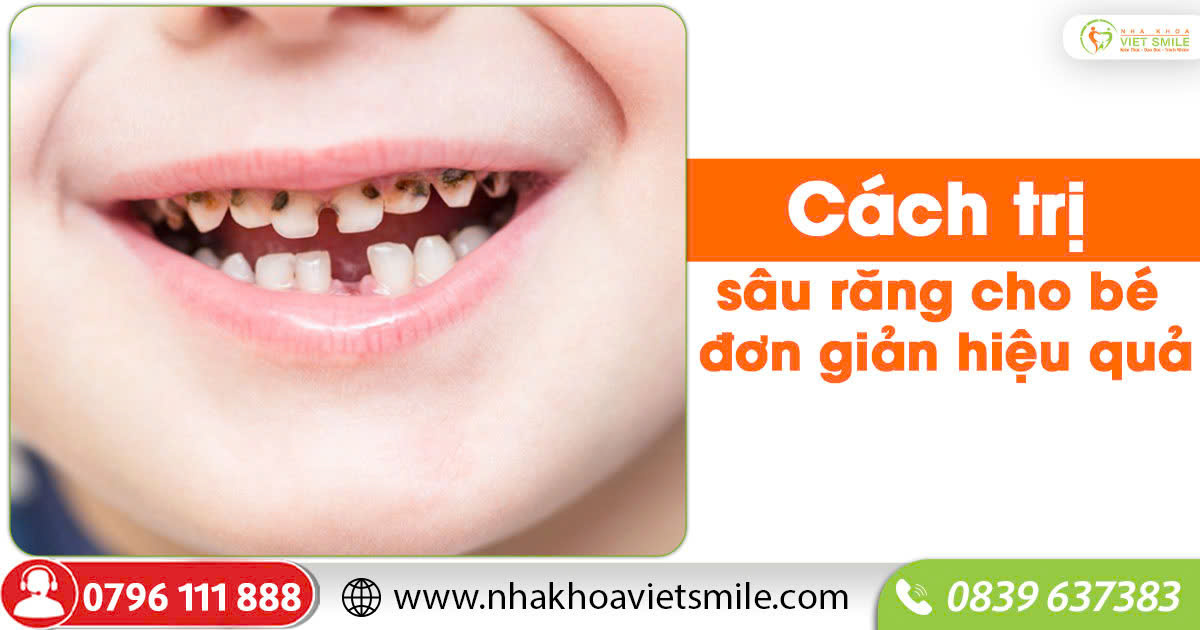 Cách trị sâu răng cho bé đơn giản hiệu quả