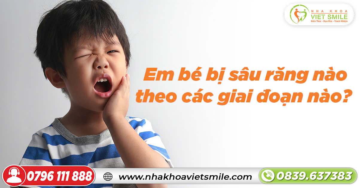 Em bé bị sâu răng nào, theo các giai đoạn nào?