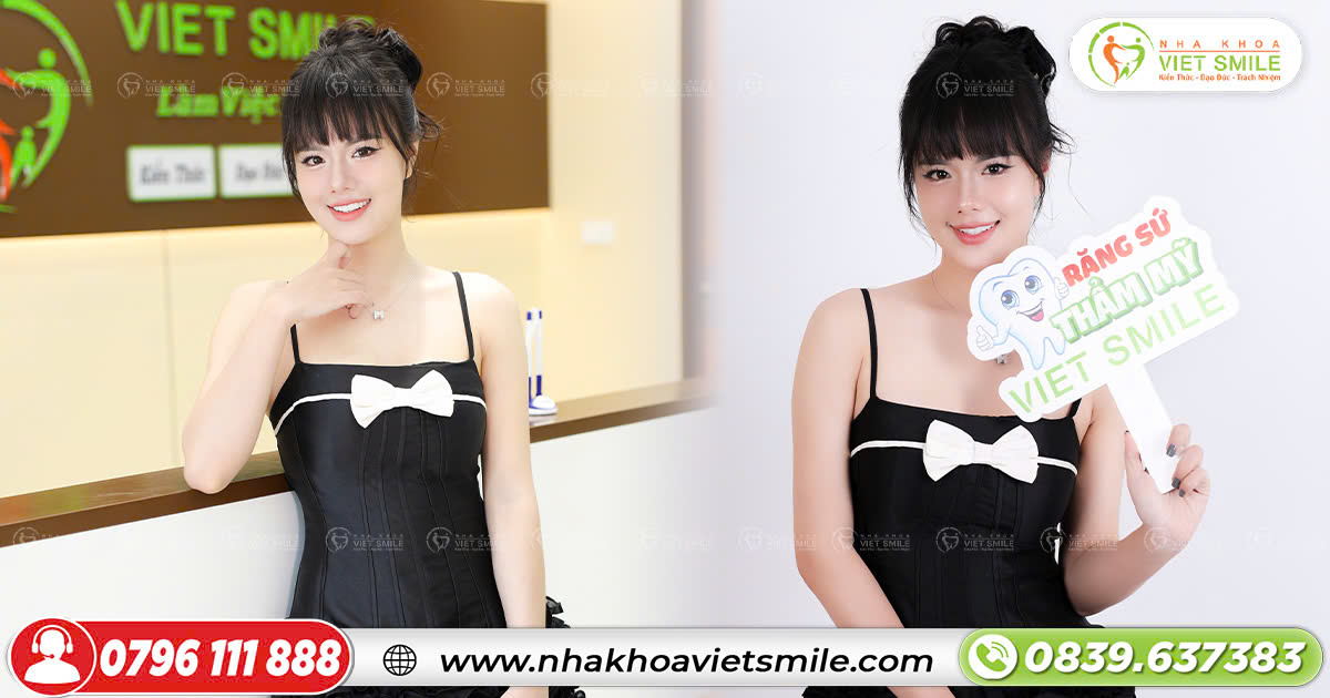 Làm răng sứ thẩm mỹ tại VIET SMILE