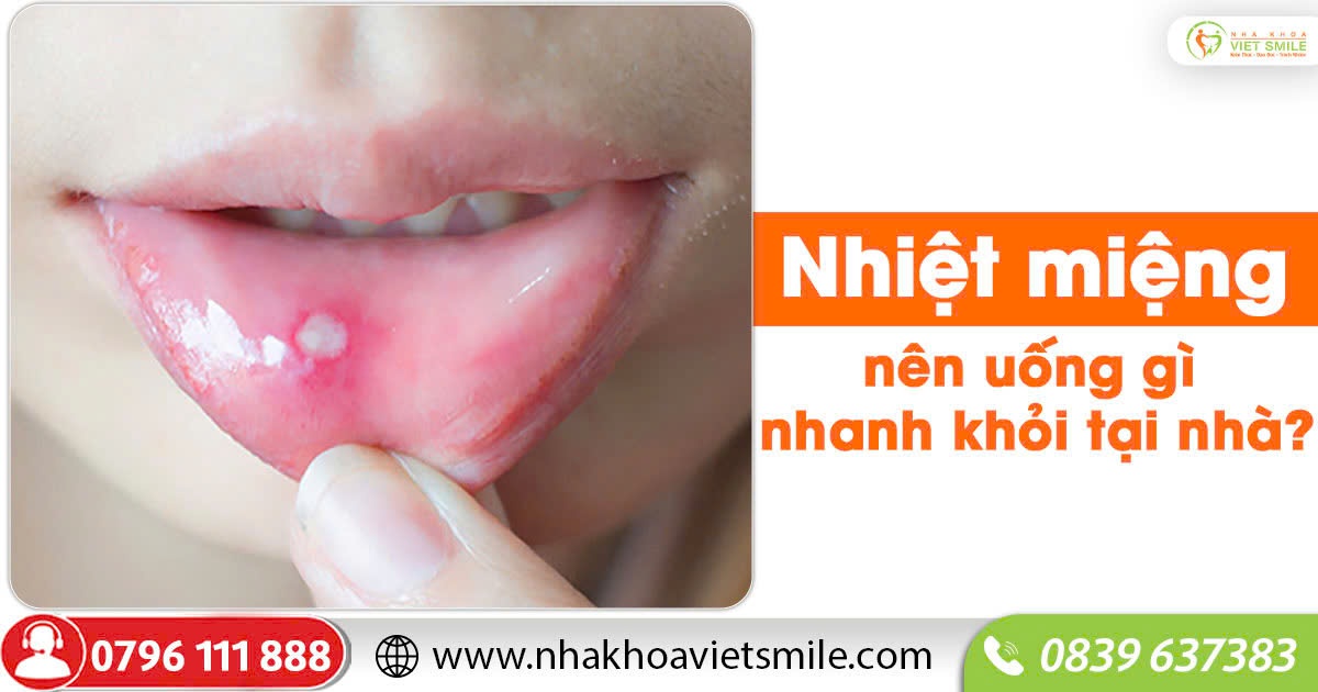 Nhiệt miệng nên uống gì nhanh khỏi tại nhà?