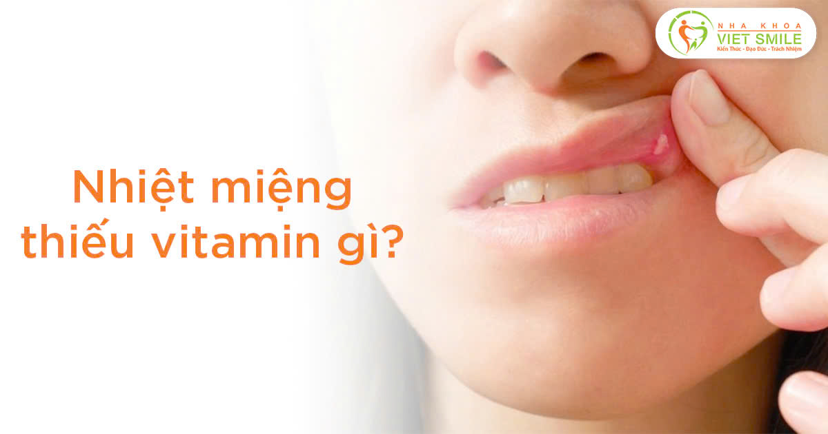 Nhiệt miệng thiếu vitamin gì?