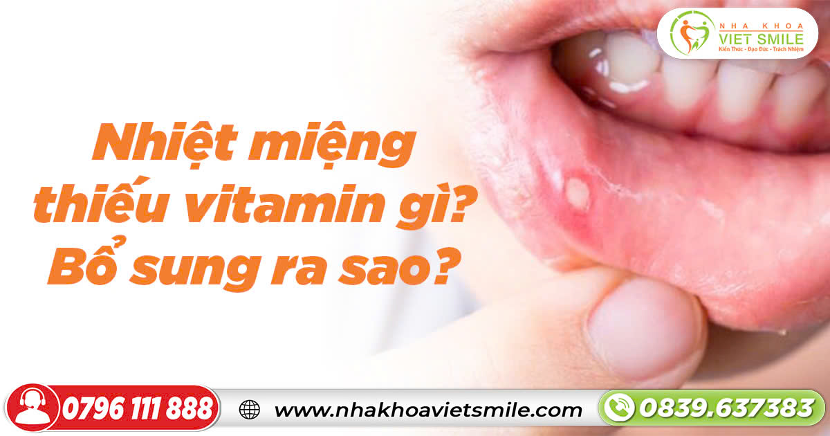 Nhiệt miệng thiếu vitamin gì? Bổ sung ra sao?