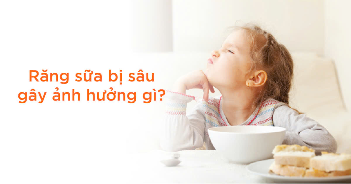 Răng sữa bị sâu gây ảnh hưởng gì?