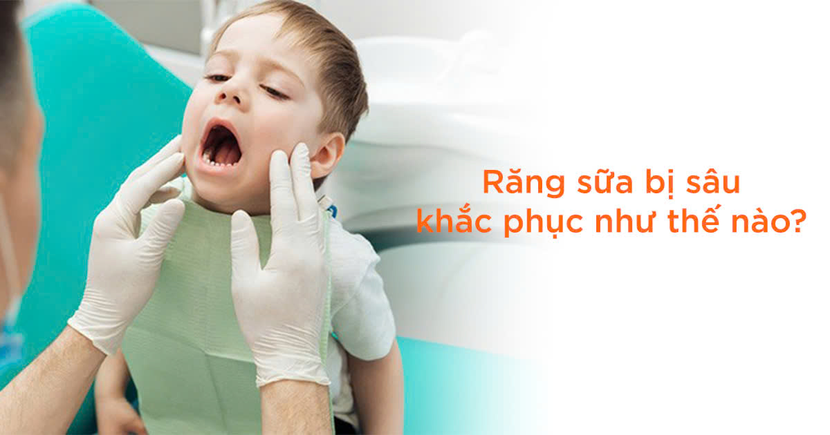 Răng sữa bị sâu khắc phục như thế nào?