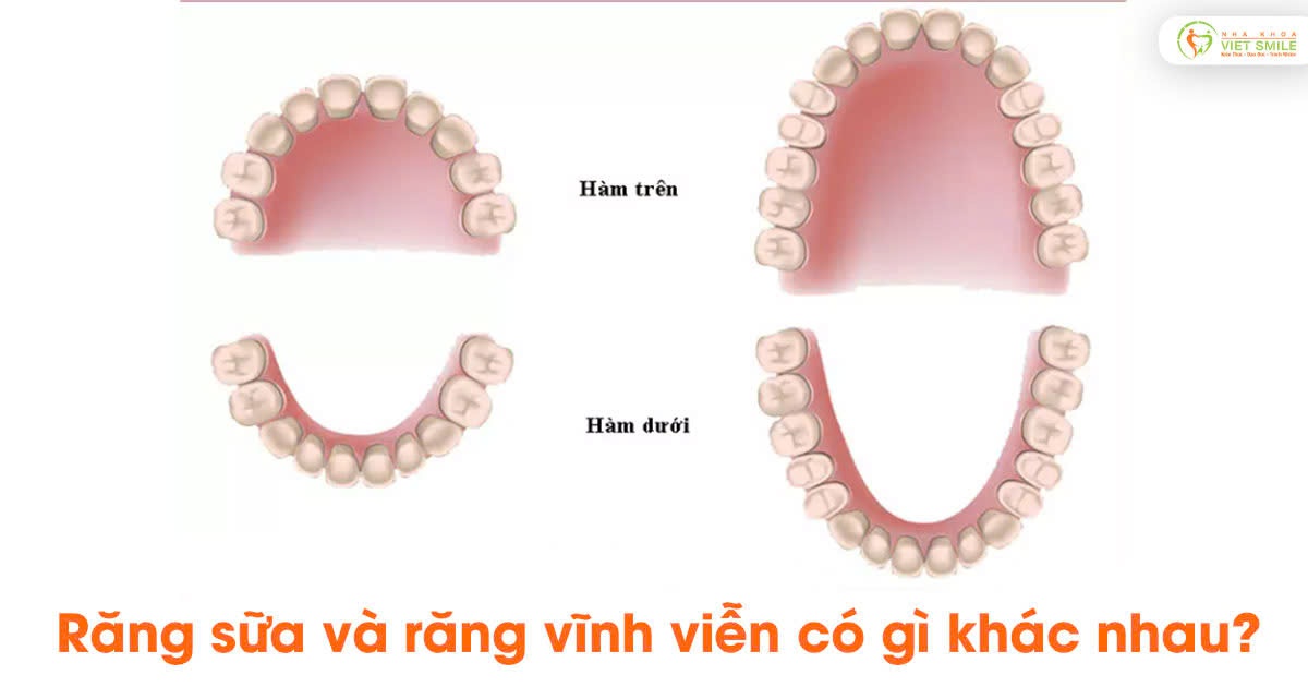 Răng sữa và răng vĩnh viễn có gì khác nhau?