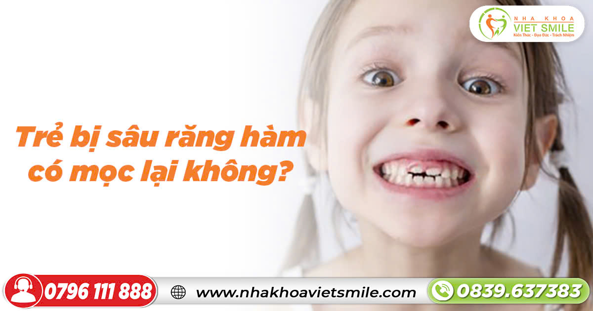 Trẻ bị sâu răng hàm có mọc lại không?