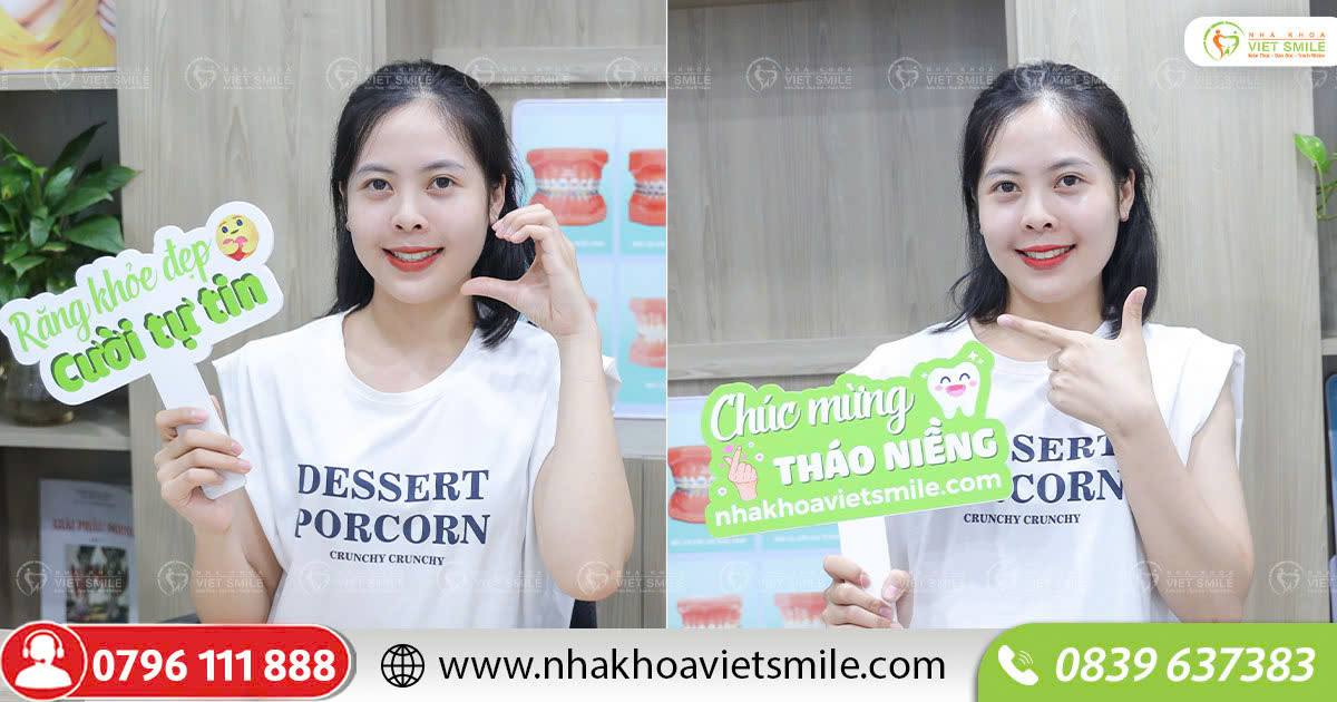 Cười đẹp, tự tin sau tháo niềng tại VIET SMILE