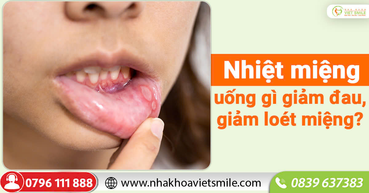 Nhiệt miệng uống gì giảm đau, giảm loét miệng?