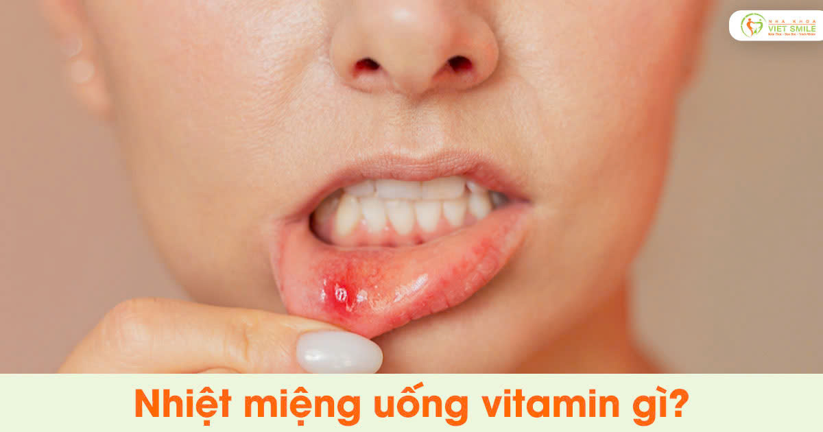 Nhiệt miệng uống vitamin gì?