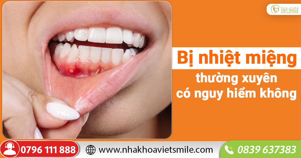 Bị nhiệt miệng thường xuyên có nguy hiểm không