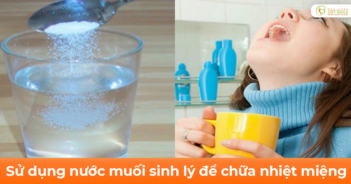 Sử dụng nước muối sinh lý để chữa nhiệt miệng