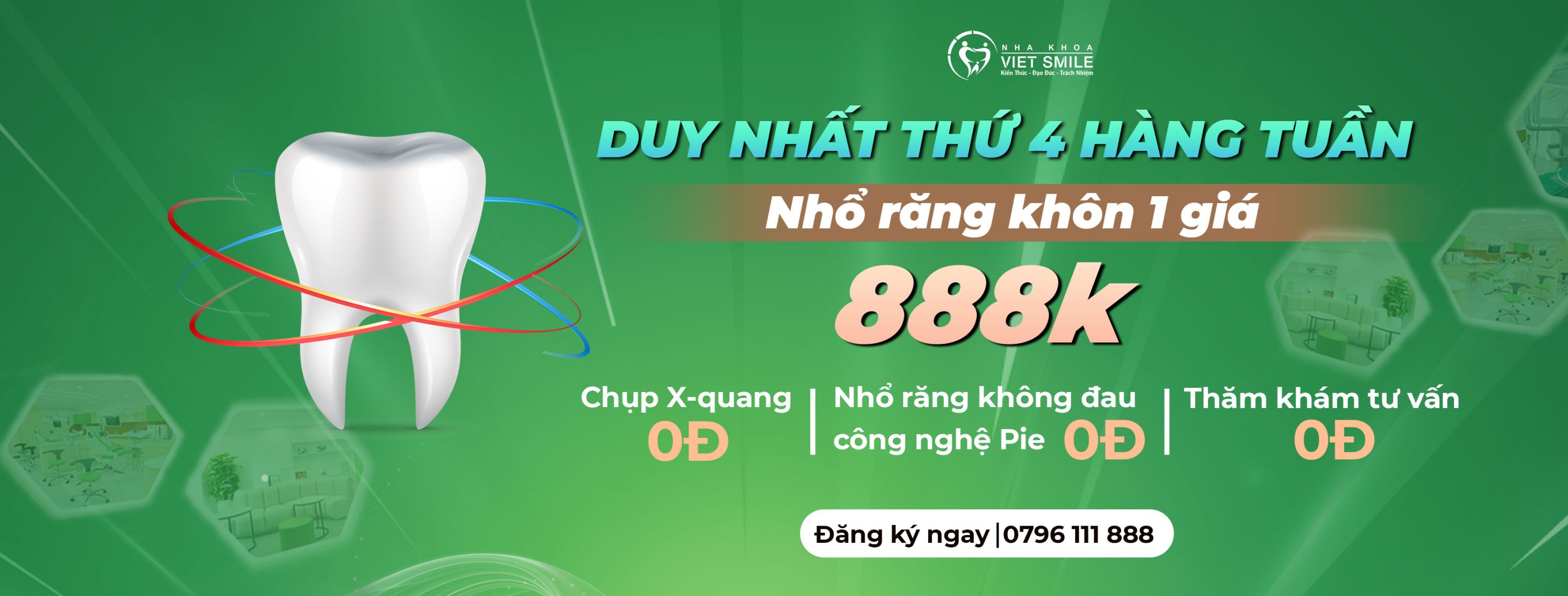 Ưu đãi nhổ răng khôn trọn gói