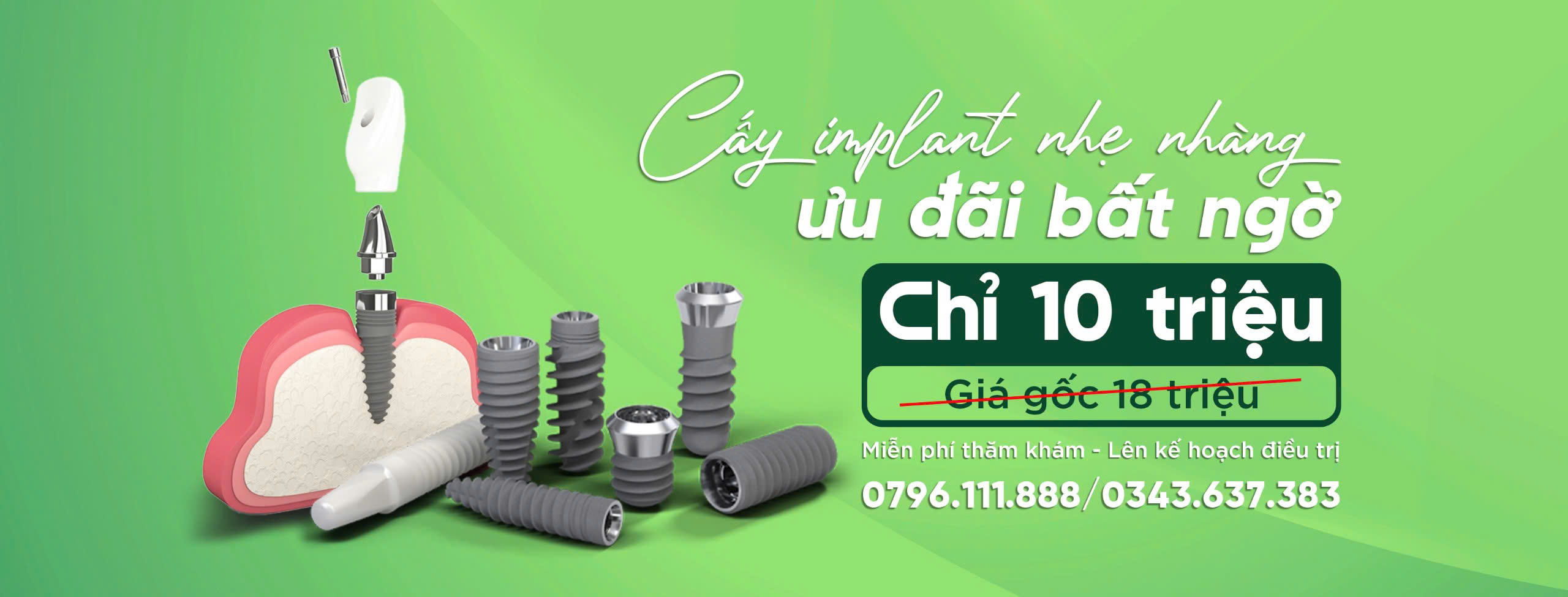 ƯU ĐÃI IMPLANT THÁNG 3