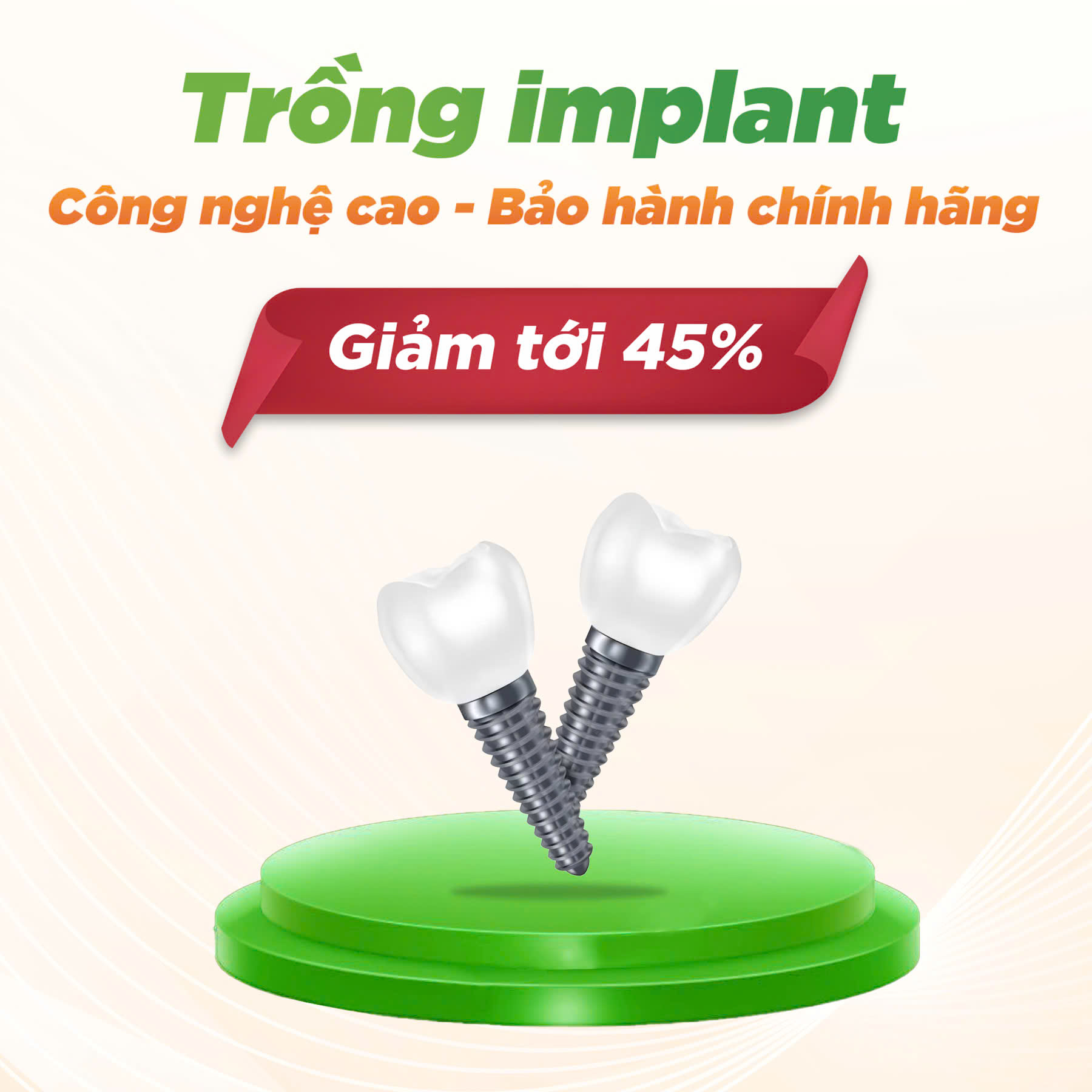 ƯU ĐÃI TRỒNG IMPLANT THÁNG 5