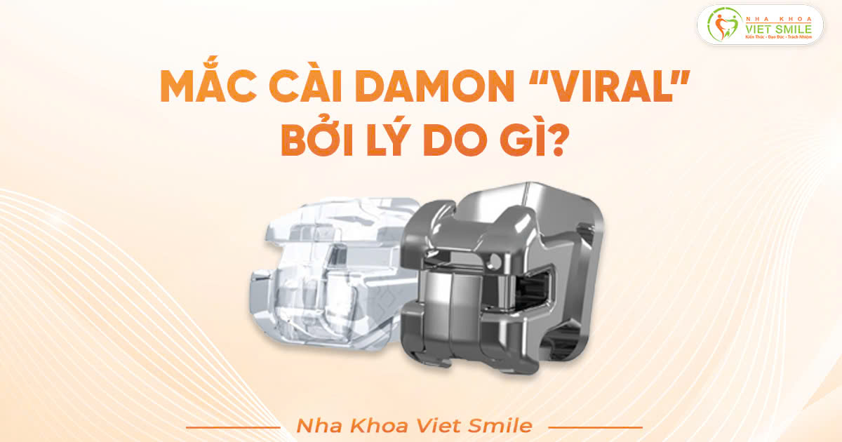 Mắc cài cài damon viril bởi lý do gì