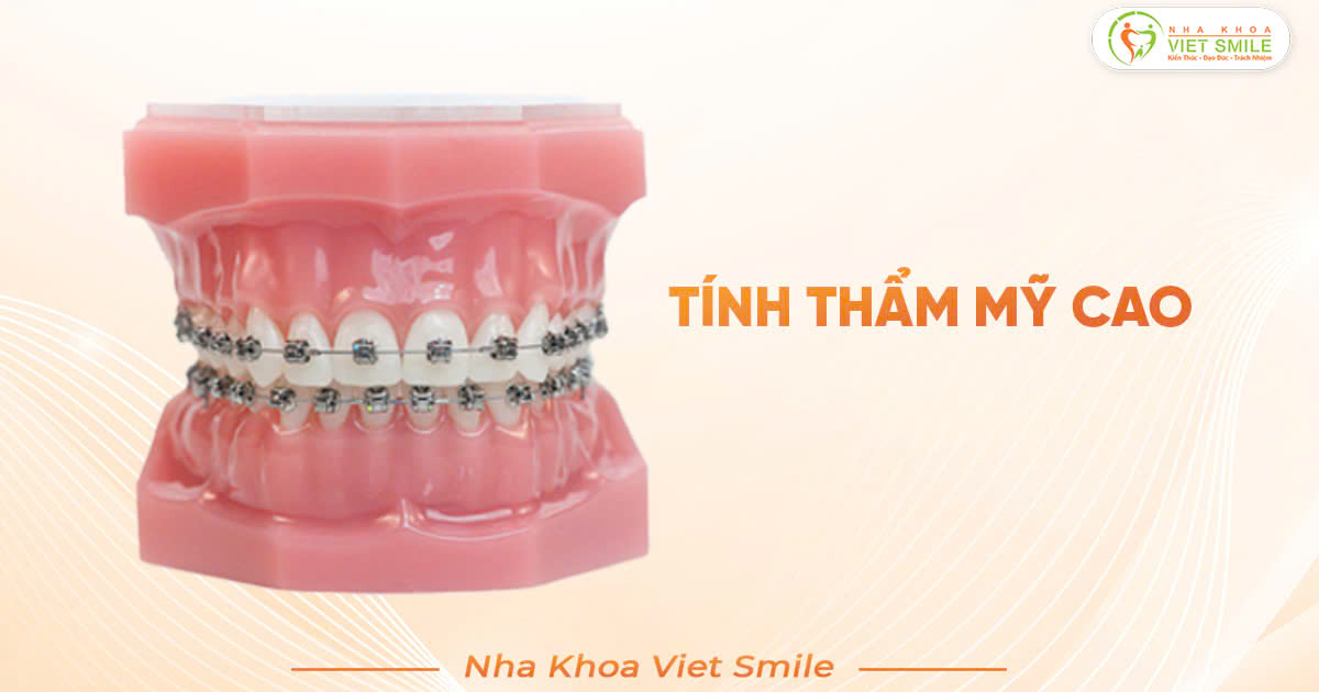Tính thẩm mỹ cao