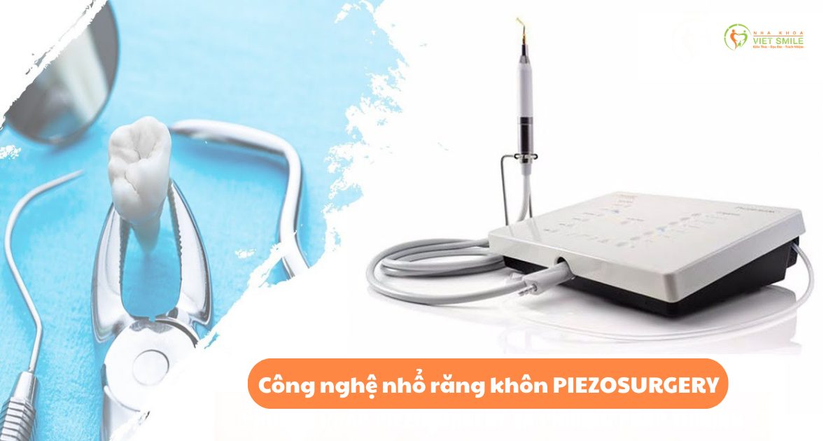 Công nghệ nhổ răng khôn PIEZOSURGERY