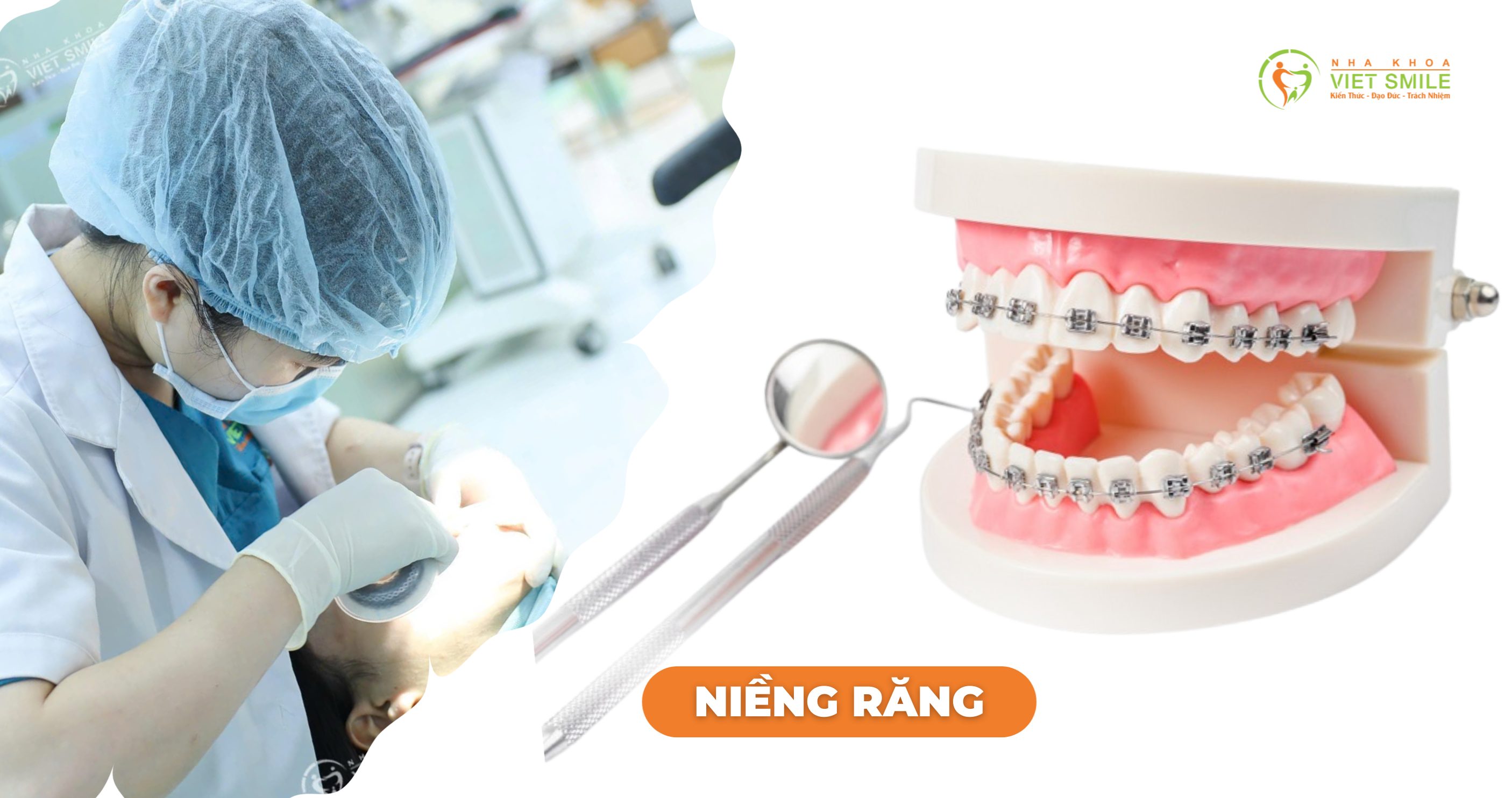 Niềng răng - Chỉnh nha