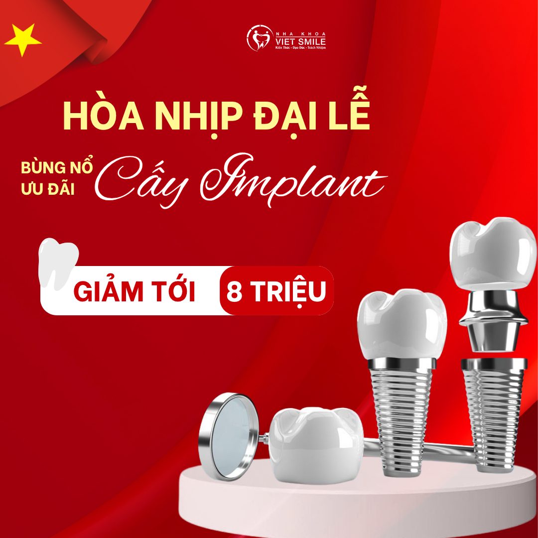 ƯU ĐÃI TRỒNG RĂNG IMPLANT THÁNG 4