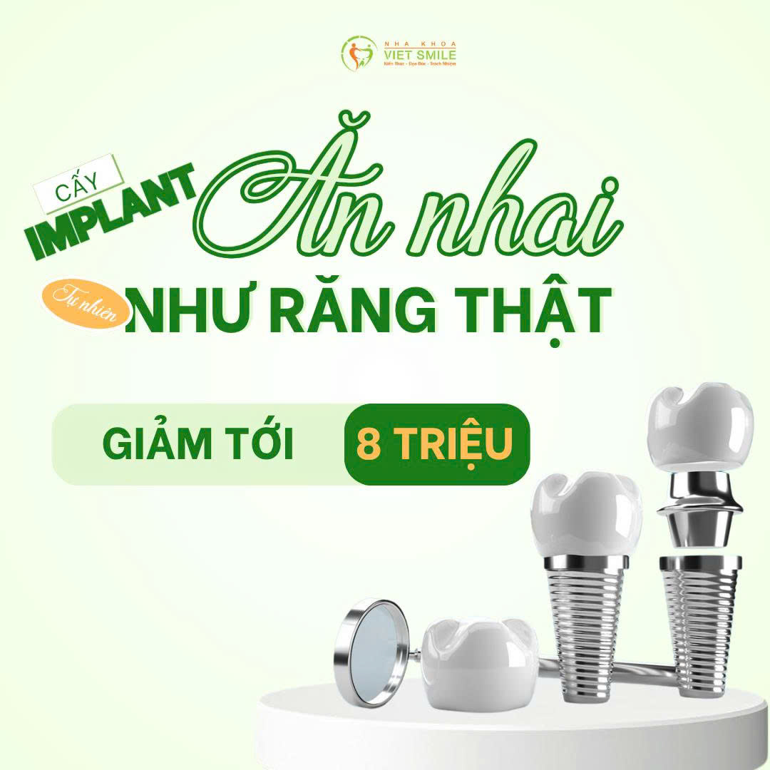 ƯU ĐÃI TRỒNG RĂNG IMPLANT THÁNG 5