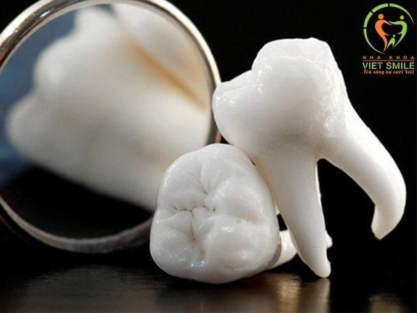 nhổ răng khôn không đau với piezotome và hồi phục nhanh cùng màng prf 2 Nho rang so 8 viet smile